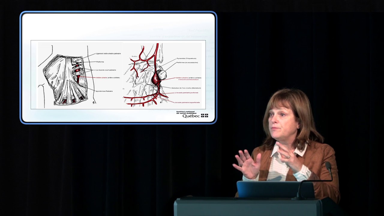 Syndrome du marteau hypothénarien chez les travailleurs exposés aux vibrations mains-bras