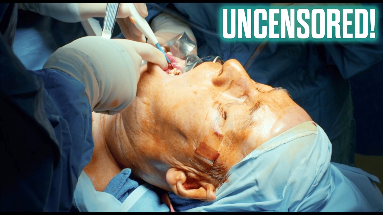 Doctors Remove Man's Cancerous Tongue & Jaw |Surgeons: A Matter Of Life And Death Full Episode S1 E1