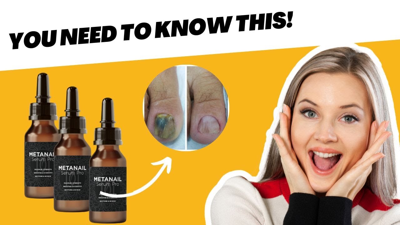 Metanail _⚠️WARNING⚠️_ Metanail serum pro review | buy Metanail serum pro | Metanail serum pro.