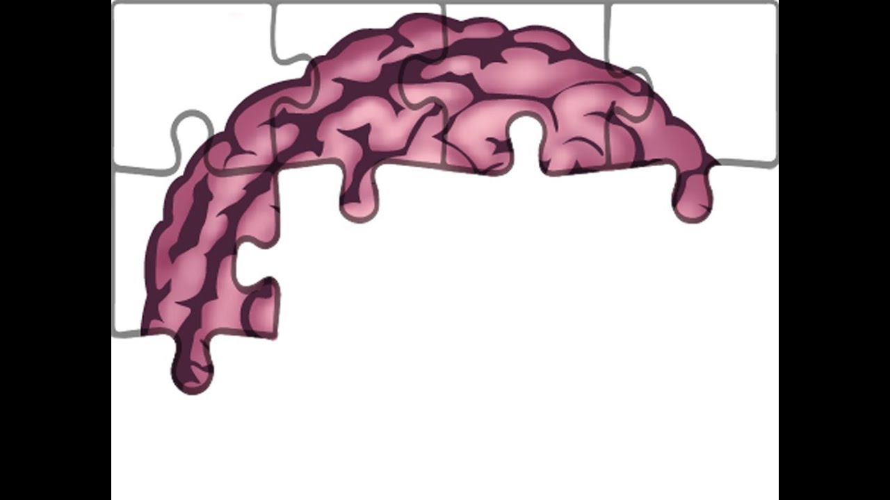 Anatomie Hirnnerven Nervus Trigeminus Teil 1 4 YouTube