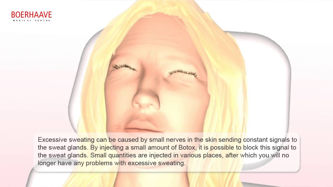 Fillers and botox Animations - Boerhaave Medical Centre - YouTube