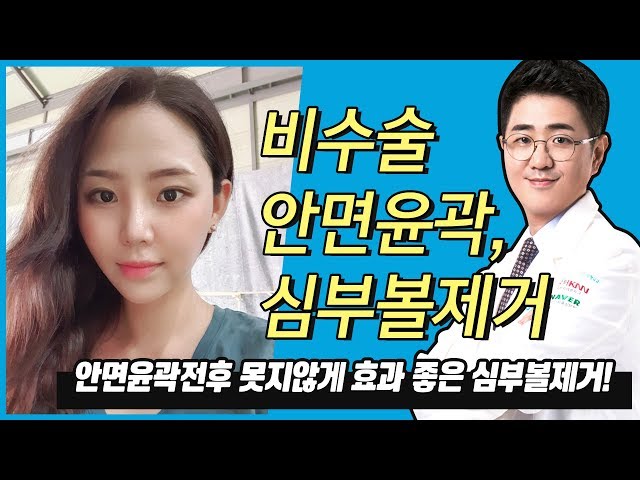 [뼈수술없는윤곽수술] 안면윤곽전후 못지 않게 효과 좋은 심부볼제거!