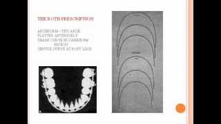 straight wire technique / Indian Dental Academy