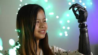 “From Limitation to Superpower: Kid’s Bionic Arm Story”