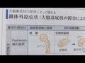 看護学生講座 136 解剖生理学 ｢錐体外路とは？　錐体外路症状を覚えよう｣
