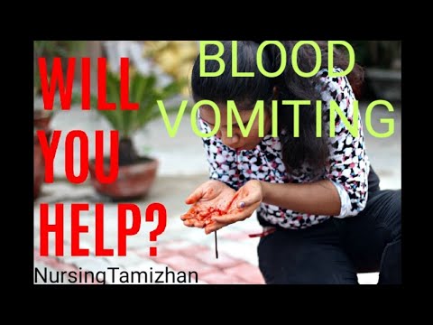 Video தமிழில் REYE'S SYNDROME ,COMPLICATION OF UPPER GI... - youtube