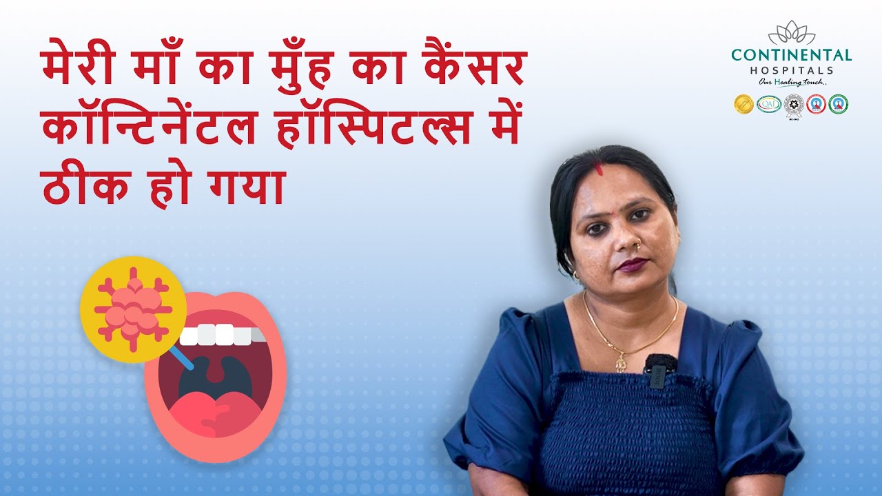 Oral Cancer Surgery Success | Continental Hospitals Hyderabad