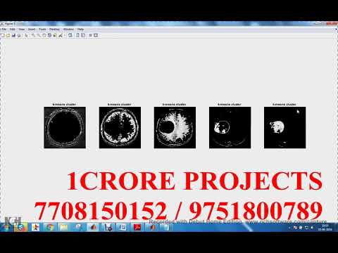 Development Of Automated Brain Tumor Identification Using MRI Images - 1Crore Projects
