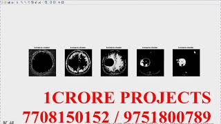 Development Of Automated Brain Tumor Identification Using MRI Images - 1Crore Projects
