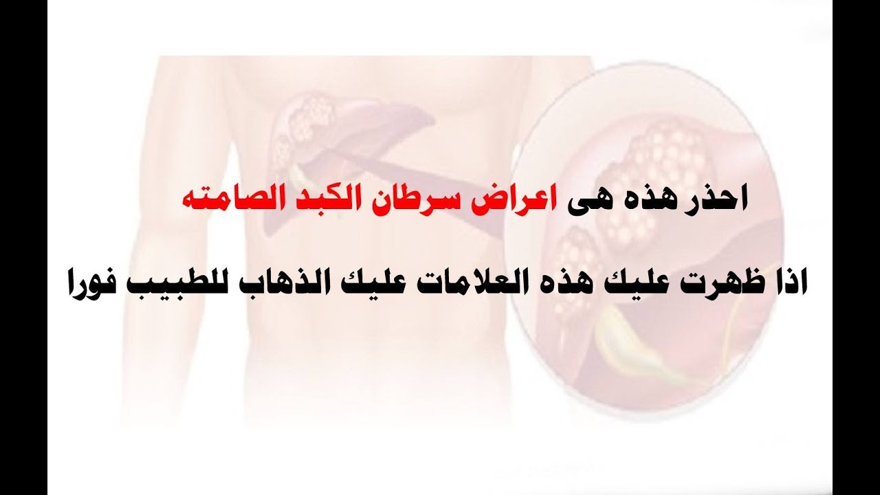احذر هذه هى اعراض سرطان الكبد الصامته Youtube