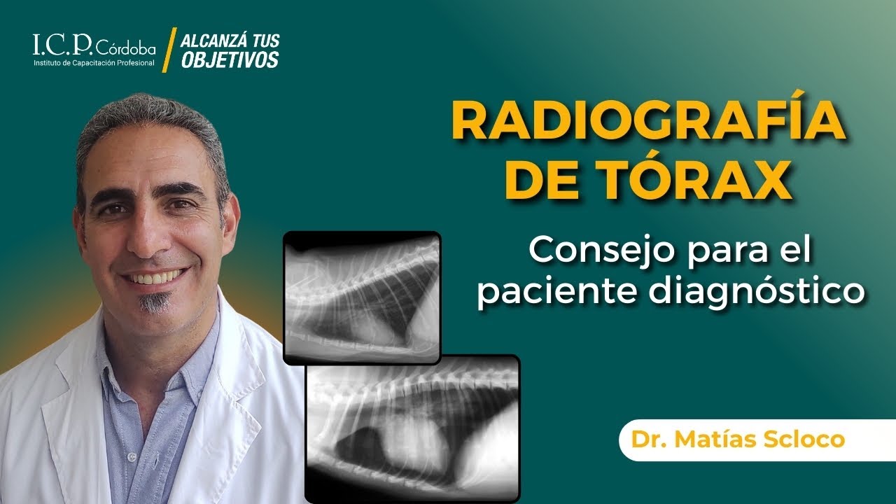 Radiografía de Tórax - Consejo para el paciente diagnóstico