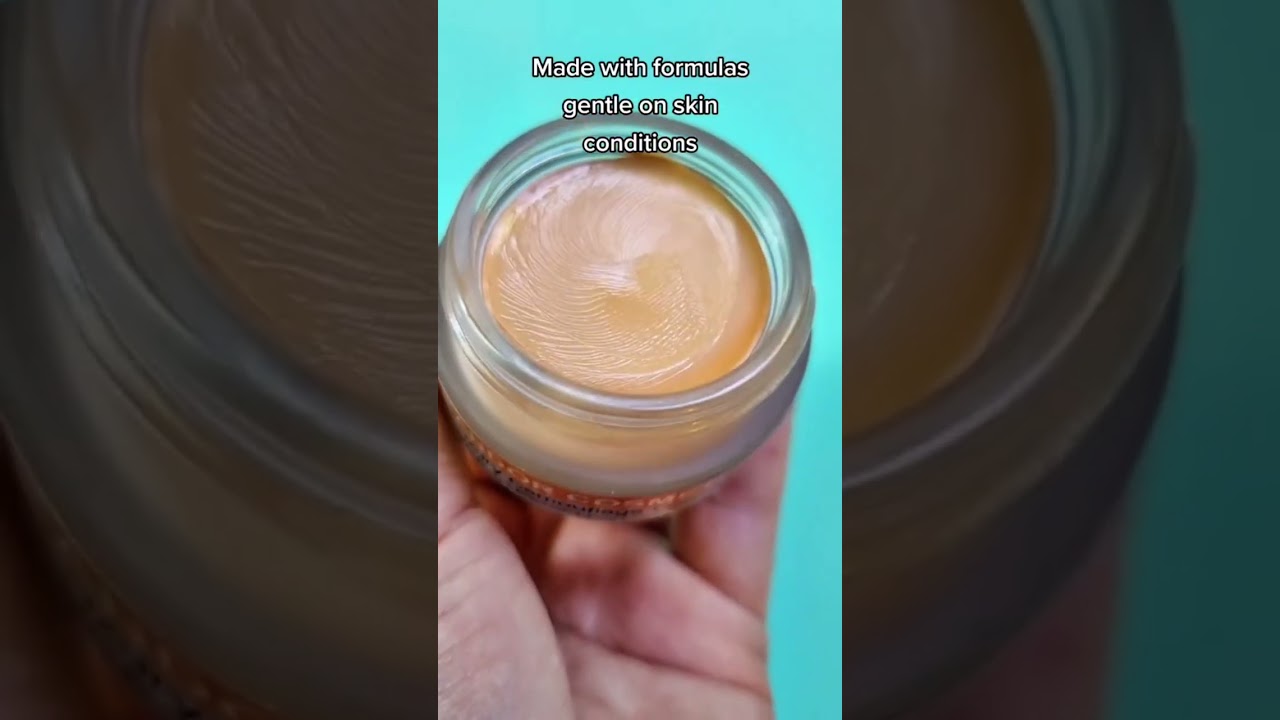 The Best Camouflage Foundation And Concealers You Will Ever Use For Acne, Eczema, Vitiligo & Others🤪