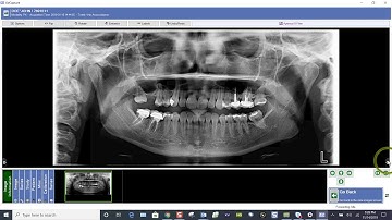 Training: Apteryx XVWeb:  Viewing Patient Images and Acquiring New Images in XVCapture