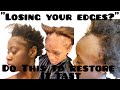 “Why African Women Are Losing Their Edges (And How to Fix It Properly)”