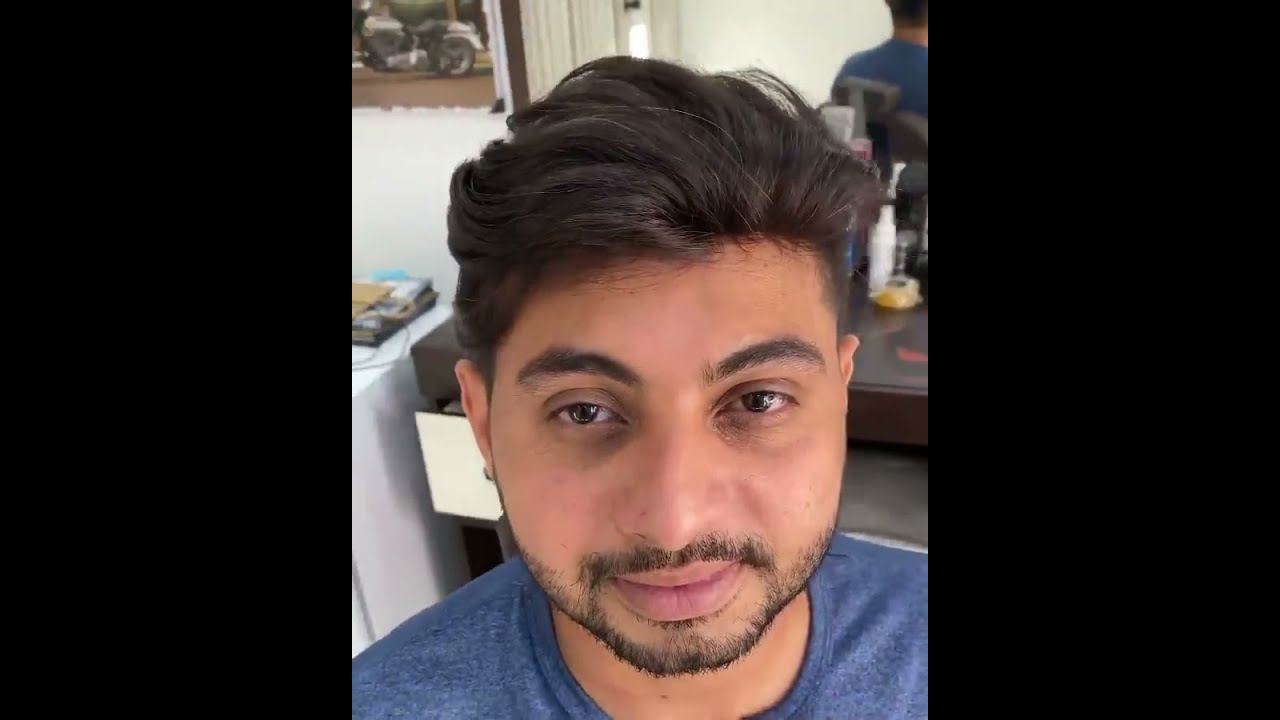 ✅ UNDETECTABLE HAIR REPLACEMENT SYSTEM BEFORE AFTER ✅ PROTESI CAPELLI INVISIBILE PRIMA E DOPO