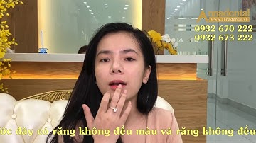 CẢM NHẬN SAU LÀM RĂNG CỦA KHÁCH HÀNG NGỌC HÂN TẠI NHA KHOA ANNA