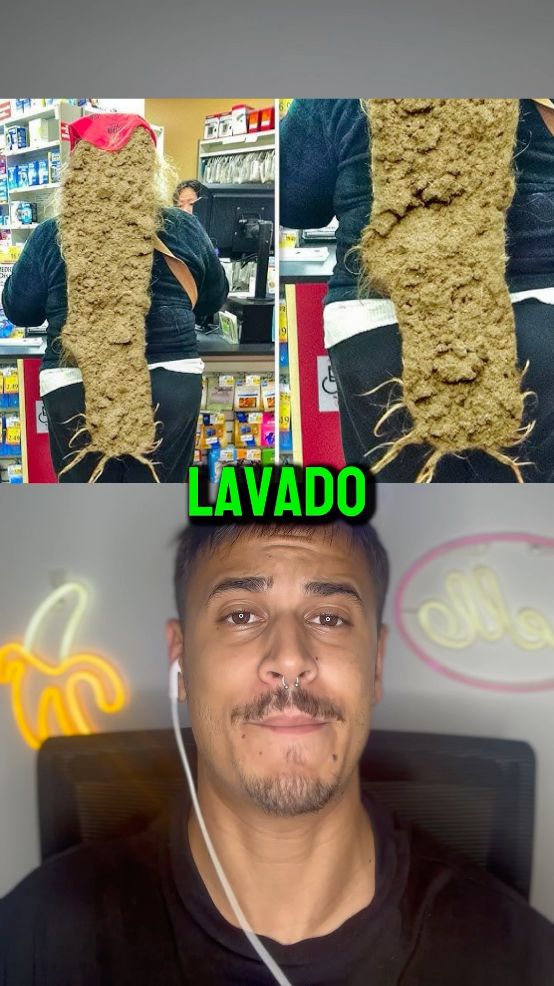 Mujer No Se Ha Lavado El Pelo En 20 Años, Lo Que Encontraron Dentro Aterrorizó A Todos ? #shorts