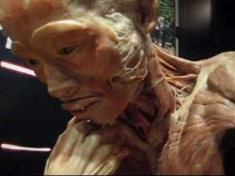 Real Preserved Human Body Show - YouTube