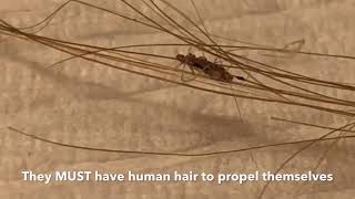 Watch How Fast Lice Move on Hair! | Real-Time Lice Footage by Picky Pam