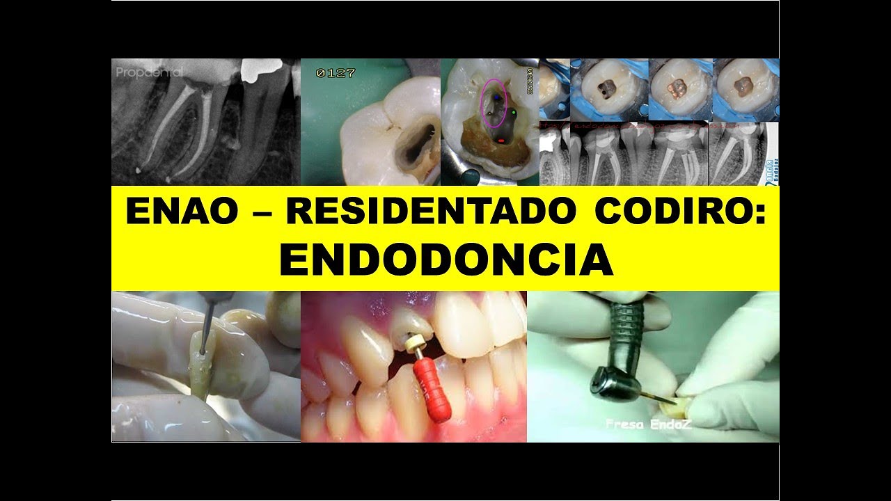 ENAO - RESIDENTADO ODONTOLÓGICO: 