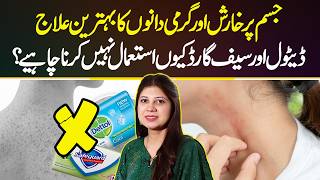 Kharish Ka ilaj | Itching Treatment | Garmi Dano Ka ilaj | Itching Problem Solution | Skincare Tips