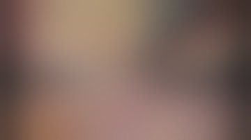 Laparoscopic basic techniques