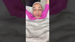 Fractional Skin Resurfacing at Dr Bhabha Aesthetics Rosebank