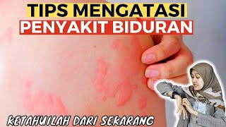 Kupas Tuntas Penyakit Kulit Biduran