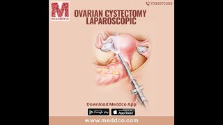 Laparoscopic Ovarian Cystectomy  | Introduction | Symptoms | Classification. Laparoscopic Cystectomy For Ovarian Reserve Optimization Protocol Preview