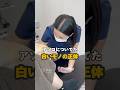 【婦人科形成術】白いモノの正体は？#shorts