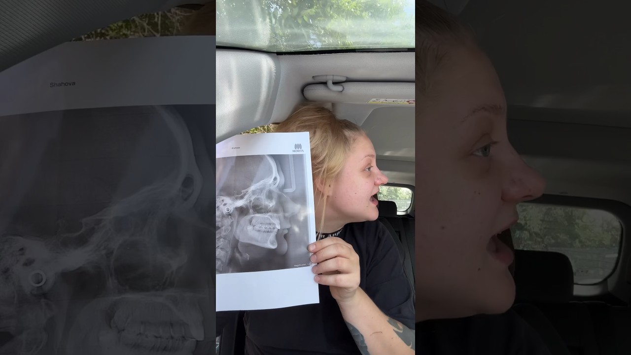 Красивая челюсть?🤣 