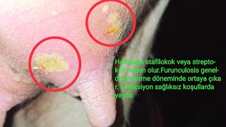 Sığır Memesinde Furunkulus(Furunkulozis)🤔‼️#vet #veterinarian #veterinary #veteriner #shorts #çıban Resimi