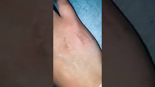 Baby Bite The Hand Then Smiles