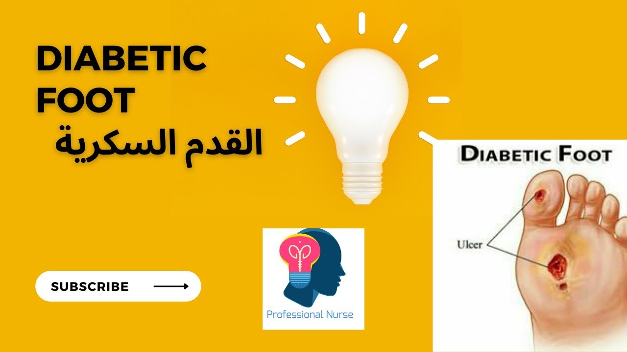 Diabetic foot | Foot Disease