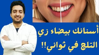 ما الفرق بين تنظيف وتبييض وتلميع الاسنان ؟؟ اسنانك بيضاء زي التلج في ثواني !!