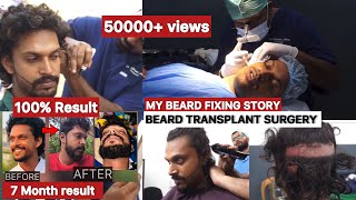 MY BEARD TRANSPLANT SURGERY 🧔‍♂️🔥100 % RESULT WITH PROOF 🔥 BEARD STORY ❤️