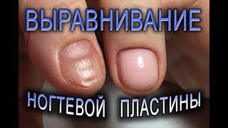 Выравнивание УКРЕПЛЕНИЕ ногтей БАЗОЙ без ОПИЛА✨как исправить КРИВОЙ ноготь.маникюр на КОРОТКИЕ НОГТИ Выравнивание УКРЕПЛЕНИЕ ногтей БАЗОЙ без ОПИЛА✨как исправить КРИВОЙ ноготь.маникюр на КОРОТКИЕ НОГТИ