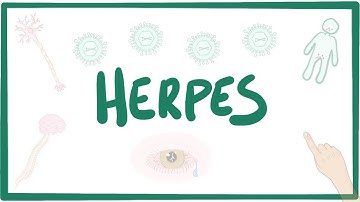 Herpes (oral & genital) - causes, symptoms, diagnosis, treatment, pathology