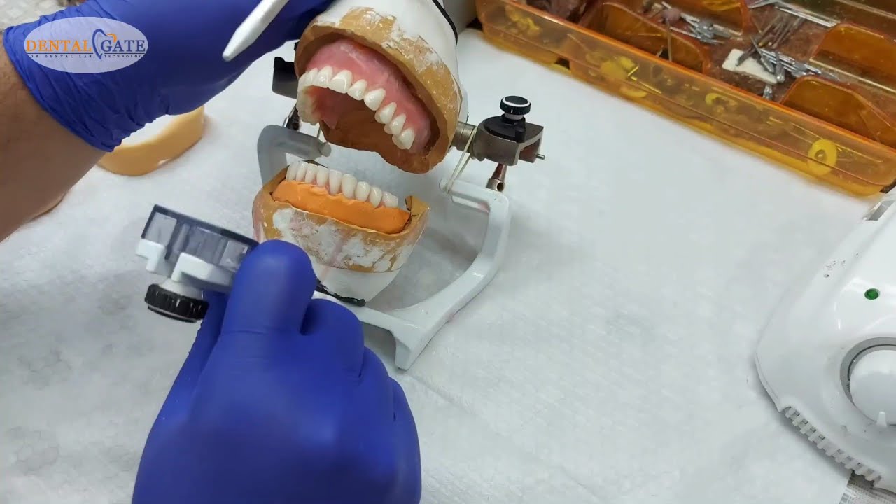 neutral zone technique in complete denture YouTube