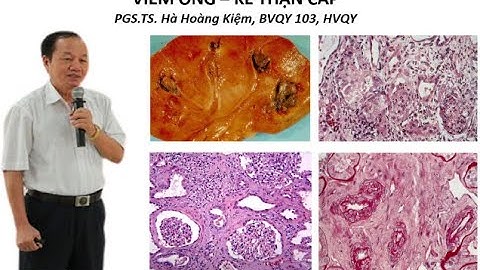 Hoàn thành các chuyển hóa sau quặng photphorit năm 2024