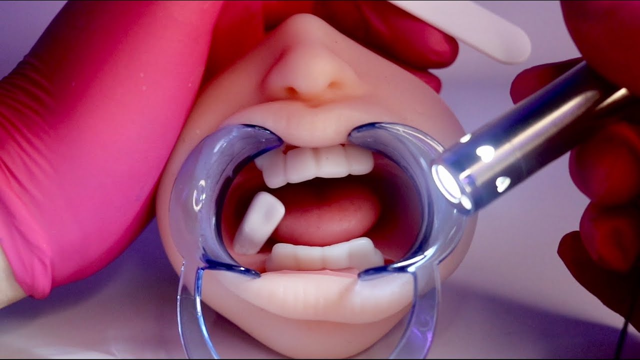 ASMR | DENTISTA 🦷 extração de dente