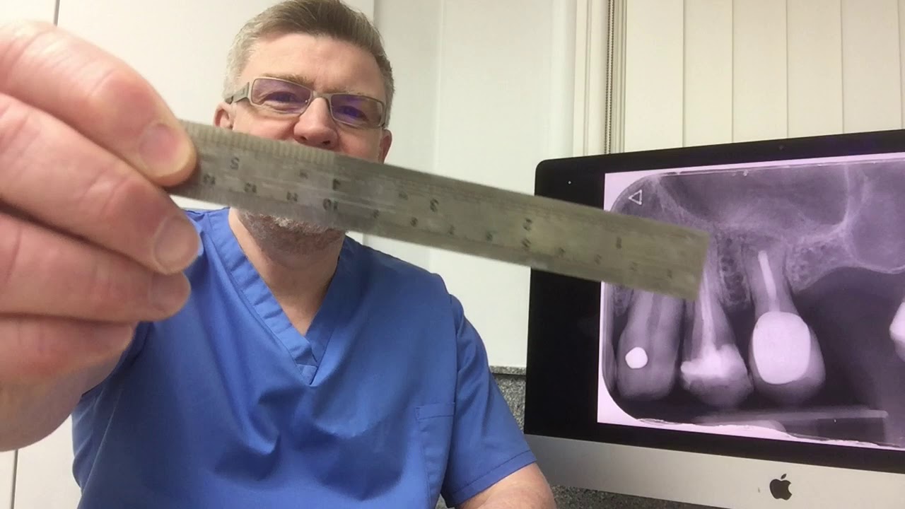 Customising the master cone YouTube