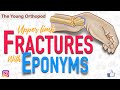 Named Fractures: UPPER LIMB, Fractures with EPONYMS, NEET PG, The Young Orthopod