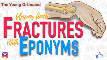 Named Fractures: UPPER LIMB, Fractures with EPONYMS, NEET PG, The Young Orthopod