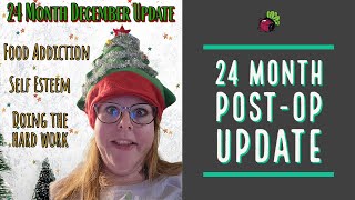 24 Month Post-Op Update // Bariatric Surgery in Mexico | My Gastric Bypass Journey