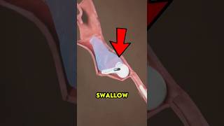 Celebrity He Swallowed His AirPod While Sleeping… What Doctors Found Will Shock You 😱#shockingstory Wealth