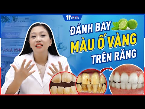 Video Răng ố vàng: Nguyên nhân và cách điều trị hiệu quả |... - youtube