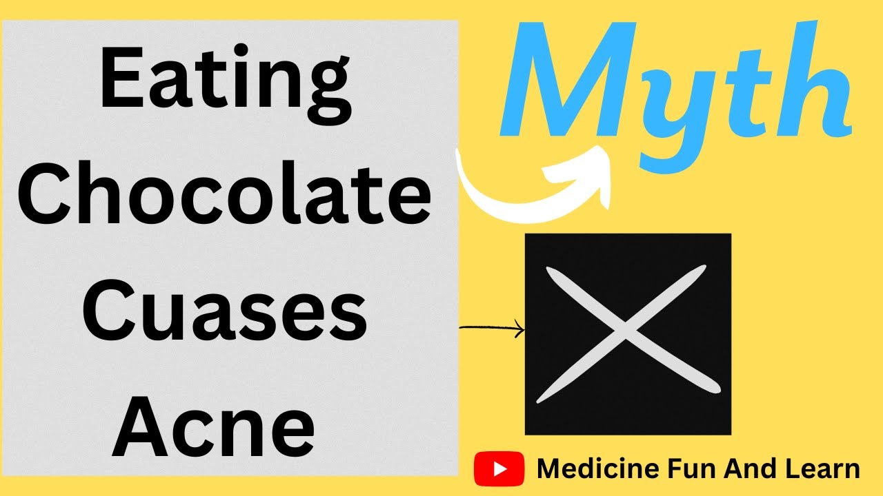 Eating Chocolate Causes Acne!!