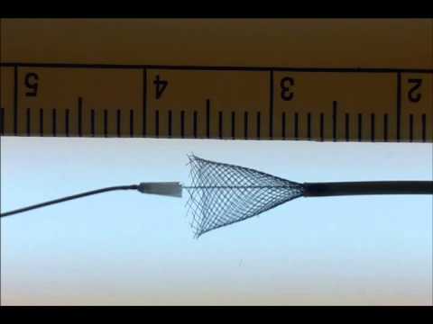 PED Flex Distal Edge Delivery