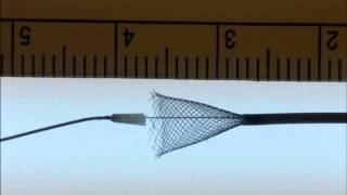 PED Flex Distal Edge Delivery
